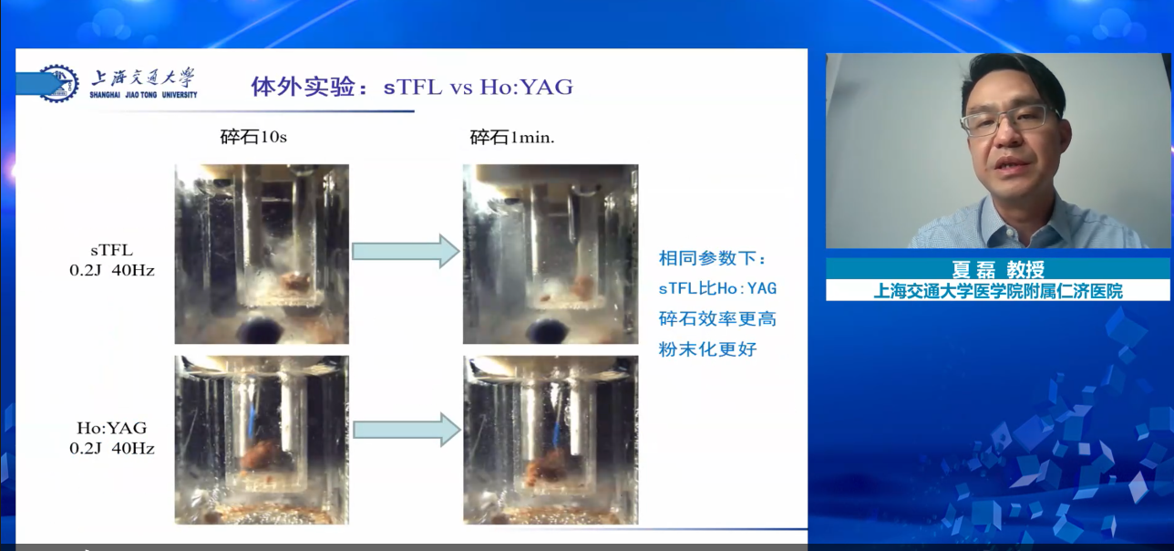 超脉冲光纤铥激光是一种安全有效的碎石激光器,Ho:YAG作为碎石激光,铥激光,医用铥激光,皇冠9393体育平台